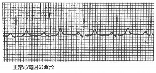 正常心電図の波形