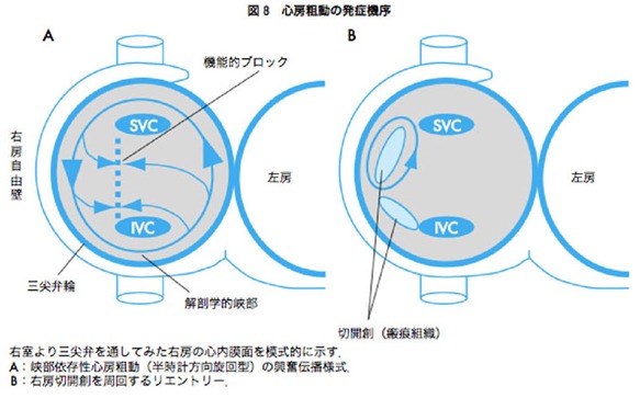 心エコー図1