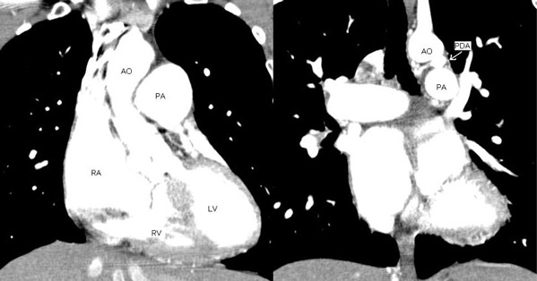 図6　造影CT検査