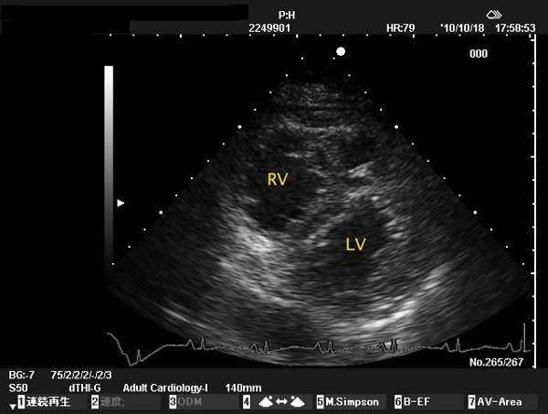 
心エコー図
