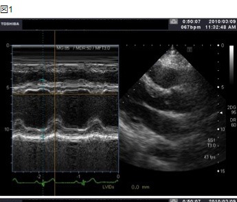 画像：心エコー