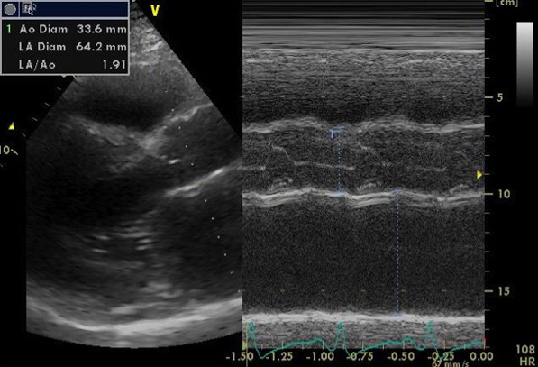 画像：心エコー画像1