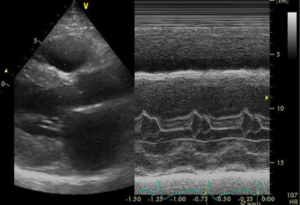 画像：心エコー画像2