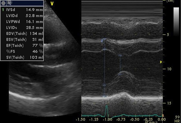 画像：心エコー画像3