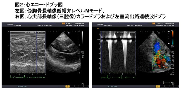 心エコー図