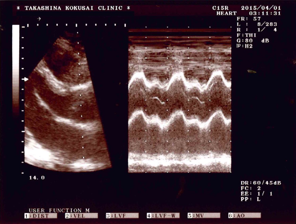 27歳男性の心エコー図