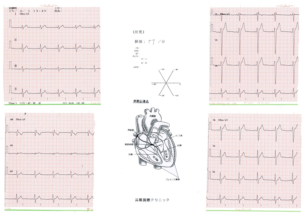27歳男性　の心電図
